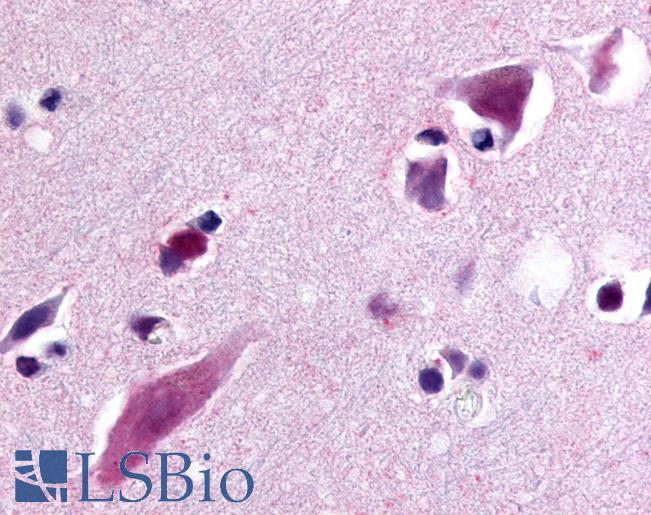 Anti-C5L2 antibody LS-A429 IHC of human brain, cortex. Immunohistochemistry of formalin-fixed, paraffin-embedded tissue after heat-induced antigen retrieval.