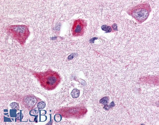 Anti-C5L2 antibody LS-A432 IHC of human brain, cortex. Immunohistochemistry of formalin-fixed, paraffin-embedded tissue after heat-induced antigen retrieval.