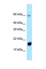 C5orf13 antibody LS-C145987 Western blot of 721_B Cell lysate. Antibody concentration 1 ug/ml.