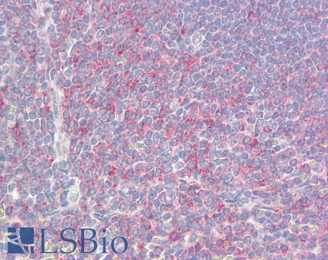Anti-C5orf13 antibody IHC of human spleen. Immunohistochemistry of formalin-fixed, paraffin-embedded tissue after heat-induced antigen retrieval. Antibody LS-B8571 dilution 5 ug/ml.