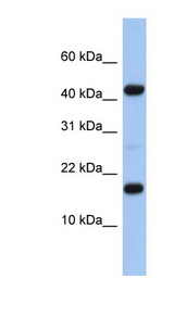 FLJ37543 antibody LS-C102683 Western blot of Fetal Heart lysate.