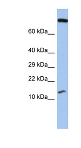 FLJ37543 antibody LS-C111681 Western blot of Fetal Stomach lysate.
