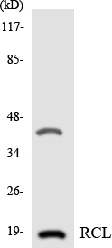 Western blot of the lysates from 293 cells using RCL antibody.