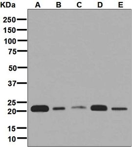 Western blot analysis on (A) K562, (B) HepG2, (C) HeLa, (D) Jurkat, and (E) MCF-7 cell lysates using anti-C6orf108 antibody.