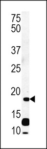 RCL Antibody western blot of CEM cell line lysates (35 ug/lane). The RCL antibody detected the RCL protein (arrow).