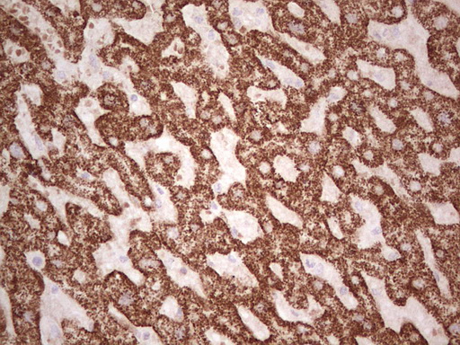 IHC of paraffin-embedded Human liver tissue using anti-ABAT mouse monoclonal antibody. (Heat-induced epitope retrieval by 1 mM EDTA in 10mM Tris, pH8.5, 120°C for 3min).