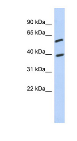 C6orf146 antibody LS-C111671 Western blot of Jurkat lysate.