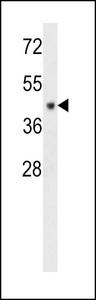 CF150 Antibody western blot of MDA-MB231 cell line lysates (35 ug/lane). The CF150 antibody detected the CF150 protein (arrow).