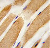 Formalin-fixed and paraffin-embedded human skeletal muscle tissue reacted with ACTB/ACTC antibody , which was peroxidase-conjugated to the secondary antibody, followed by DAB staining. This data demonstrates the use of this antibody for immunohistochemistry; clinical relevance has not been evaluated.