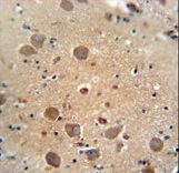 CF062 antibody immunohistochemistry of formalin-fixed and paraffin-embedded human brain tissue followed by peroxidase-conjugated secondary antibody and DAB staining.