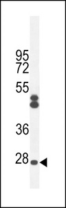 CF062 Antibody western blot of CHO cell line lysates (35 ug/lane). The CF062 antibody detected the CF062 protein (arrow).