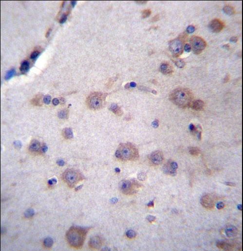 NDUFAF4 Antibody immunohistochemistry of formalin-fixed and paraffin-embedded human brain tissue followed by peroxidase-conjugated secondary antibody and DAB staining.