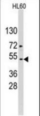 Western blot of ACTB/ACTC Antibody in HL60 cell line lysates (35 ug/lane). Target protein (arrow) was detected using the purified antibody.