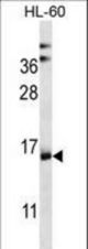 NDUFAF4 Antibody western blot of HL-60 cell line lysates (35 ug/lane). The NDUFAF4 antibody detected the NDUFAF4 protein (arrow).