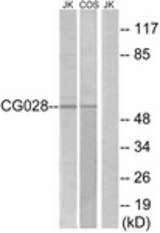 Western blot of extracts from Jurkat/COS cells, using CG028 Antibody. The lane on the right is treated with the synthesized peptide.