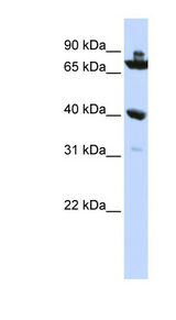 C7orf31 antibody LS-C111418 Western blot of HepG2 cell lysate.