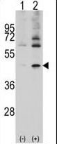 Western blot of ACTB/ACTC (arrow) using rabbit polyclonal ACTB/ACTC Antibody. 293 cell lysates (2 ug/lane) either nontransfected (Lane 1) or transiently transfected with the ACTB/ACTC gene (Lane 2) (Origene Technologies).
