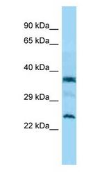 C7orf61 antibody Western Blot of Jurkat.