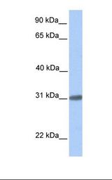 Fetal brain lysate. Antibody concentration: 1.0 ug/ml. Gel concentration: 12%.