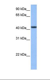 Hela cell lysate. Antibody concentration: 1.0 ug/ml. Gel concentration: 12%.