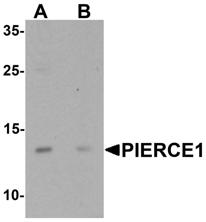Western blot analysis of PIERCE1 in A20 cell lysate with PIERCE1 antibody at 1 ug/ml in (A) the absence and (B) the presence of blocking peptide.