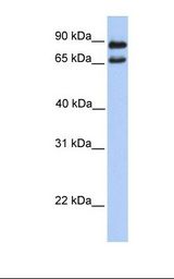 721_B cell lysate. Antibody concentration: 1.0 ug/ml. Gel concentration: 12%.
