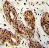 CI150 Antibody immunohistochemistry of formalin-fixed and paraffin-embedded human breast tissue followed by peroxidase-conjugated secondary antibody and DAB staining.