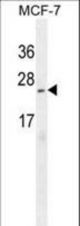 CI150 Antibody western blot of MCF-7 cell line lysates (35 ug/lane). The CI150 antibody detected the CI150 protein (arrow).