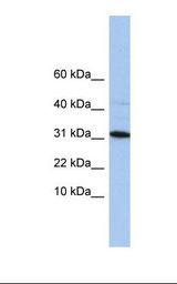HepG2 cell lysate. Antibody concentration: 1.0 ug/ml. Gel concentration: 10-20%.