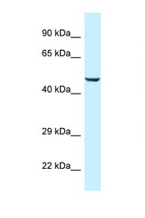 C9orf156 antibody LS-C145633 Western blot of Fetal Heart lysate. Antibody concentration 1 ug/ml.