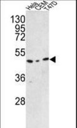 Western blot of C9orf156 Antibody in HeLa, CEM, T47D cell line lysates (35 ug/lane). C9orf156 (arrow) was detected using the purified antibody.