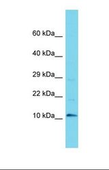 Western blot of Human MCF7. C9orf170 antibody dilution 1.0 ug/ml.
