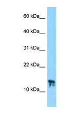 C9orf25 antibody LS-C146355 Western blot of Mouse Thymus lysate. Antibody concentration 1 ug/ml.