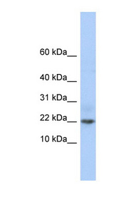C9orf25 antibody LS-C102651 Western blot of Jurkat lysate.