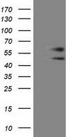 HEK293T cells were transfected with the pCMV6-ENTRY control (Left lane) or pCMV6-ENTRY C9orf41 (Right lane) cDNA for 48 hrs and lysed. Equivalent amounts of cell lysates (5 ug per lane) were separated by SDS-PAGE and immunoblotted with anti-C9orf41.