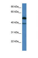 C9orf64 antibody LS-C135498 Western blot of COL0205 Cell lysate. Antibody concentration 1 ug/ml.