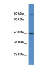 C9orf64 antibody LS-C135791 Western blot of HeLa Cell lysate. Antibody concentration 1 ug/ml.