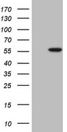 HEK293T cells were transfected with the pCMV6-ENTRY control (Left lane) or pCMV6-ENTRY ABAT (Right lane) cDNA for 48 hrs and lysed. Equivalent amounts of cell lysates (5 ug per lane) were separated by SDS-PAGE and immunoblotted with anti-ABAT.
