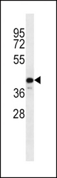 C9orf72 Antibody western blot of MDA-MB231 cell line lysates (35 ug/lane). The C9orf72 antibody detected the C9orf72 protein (arrow).
