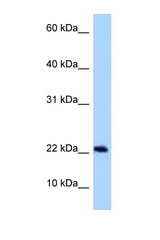C9orf9 antibody LS-C146346 Western blot of Rat Muscle lysate. Antibody concentration 1 ug/ml.