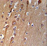 CI091 Antibody IHC of formalin-fixed and paraffin-embedded brain tissue followed by peroxidase-conjugated secondary antibody and DAB staining.