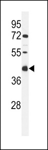 Western blot of CI091 Antibody in MCF-7 cell line lysates (35 ug/lane). CI091 (arrow) was detected using the purified antibody.