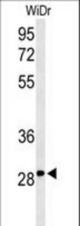 Western blot of C9orf95 Antibody in WiDr cell line lysates (35 ug/lane). C9orf95 (arrow) was detected using the purified antibody.