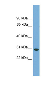 CA5B antibody LS-C116476 Western blot of THP-1 cell lysate.