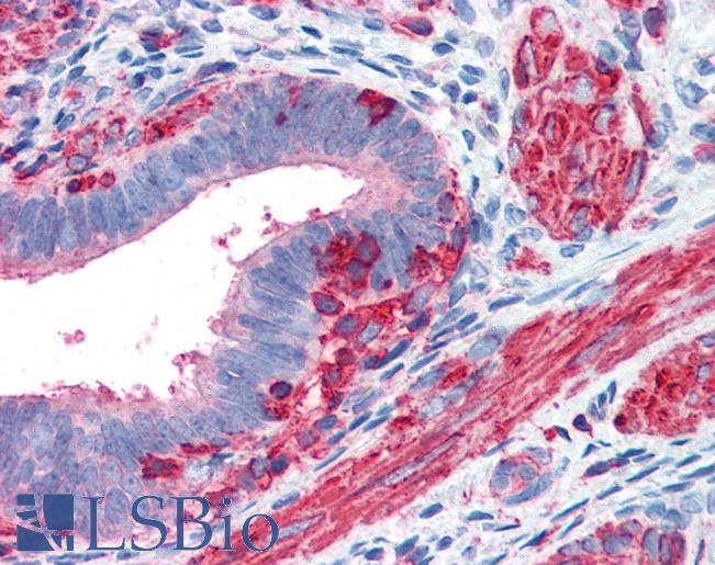 Anti-Beta Actin antibody IHC of human uterus. Immunohistochemistry of formalin-fixed, paraffin-embedded tissue after heat-induced antigen retrieval. Antibody LS-B2538 concentration 5 ug/ml.