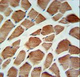 CA5B Antibody IHC of formalin-fixed and paraffin-embedded human skeletal muscle followed by peroxidase-conjugated secondary antibody and DAB staining.
