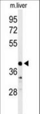 Western blot of CA5B Antibody in mouse liver tissue lysates (35 ug/lane). CA5B (arrow) was detected using the purified antibody.