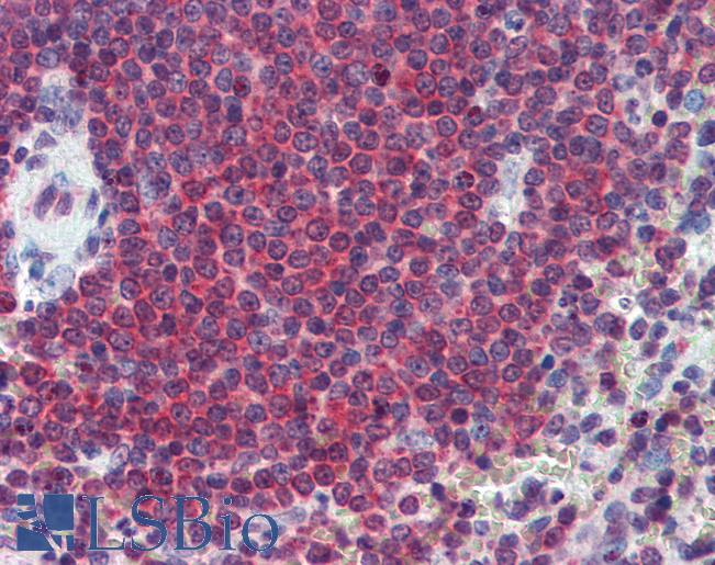 Anti-CA1 / Carbonic Anhydrase I antibody IHC of human spleen. Immunohistochemistry of formalin-fixed, paraffin-embedded tissue after heat-induced antigen retrieval. Antibody LS-B3971 concentration 2.5 ug/ml.