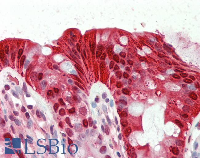 Anti-CA1 / Carbonic Anhydrase I antibody IHC staining of human colon. Immunohistochemistry of formalin-fixed, paraffin-embedded tissue after heat-induced antigen retrieval. Antibody LS-B10420 concentration 5 ug/ml.