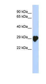 CA1 / Carbonic Anhydrase I antibody Western blot of Placenta lysate.